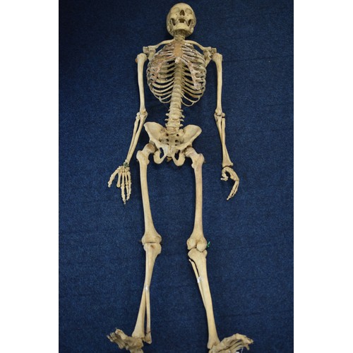 536a - Antique Real Adult Human Skeleton approx 63